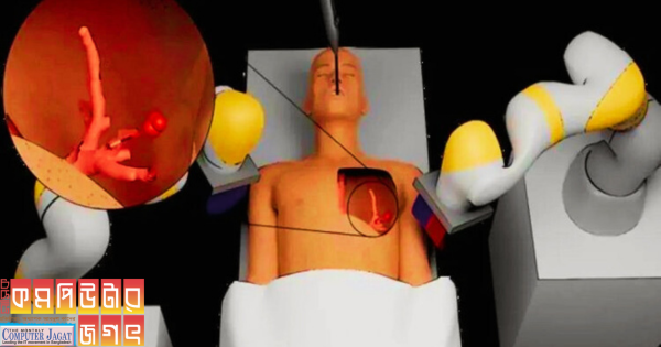 টিউমার অপসারণ করবে রোবট