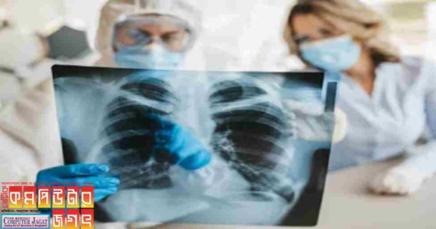 বাংলাদেশেও এক্স-রে মেশিনে এআই প্রযুক্তি