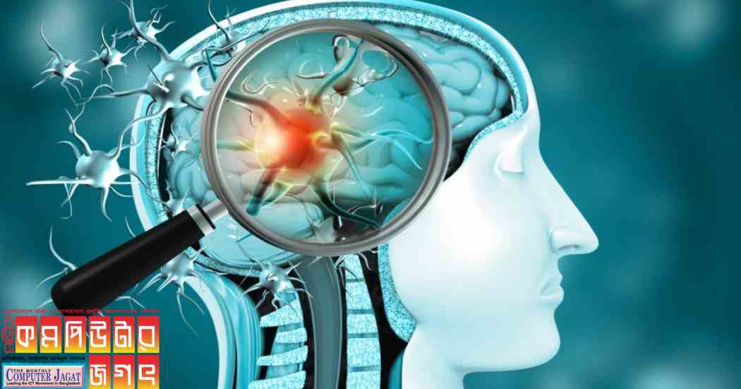 কৃত্রিম বুদ্ধিমত্তা জানাবে মস্তিষ্কের ক্যানসারে আক্রান্ত ব্যক্তি কত দিন বাঁচতে পারবেন